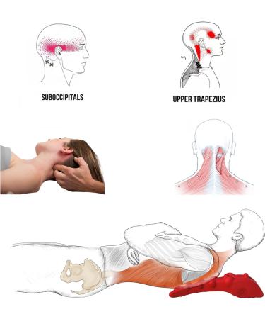 Littlemum Trapezius Trigger Point Massage Device - Relieve Neck Pain Neuralgia Tension & Headaches - Buy Online on GoSupps.com