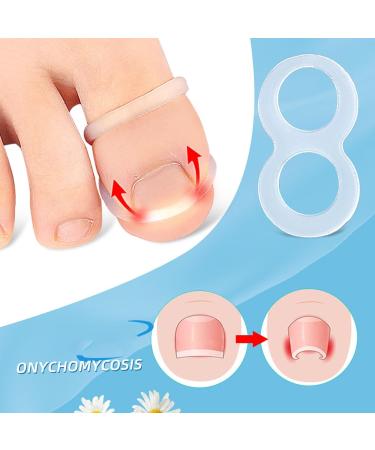 Ingrown Toenail Corrector Providing Quick Relief & Secure Fit Effective Recovery Versatile Usage Made From Transparent Silicone - Buy Online on GoSupps.com