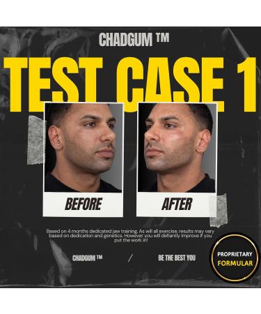 JAWTONE CHADGUM Hard Mewing JAWLINE GUM puissant exercice de m choire 2 mois d'approvisionnement Jawline shaper | Exerciseur de m choire pour les hommes qui souhaitent am liorer Menthe Xylitol  - Buy Online on GoSupps.com