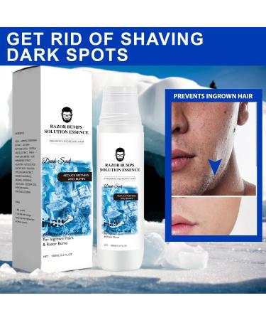  EverestBeauty Razor Bump Ingrown Hair Treatment Solution 100ml - Buy Online on GoSupps.com