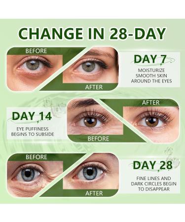 60 Pi ces Patch Yeux Anti Cernes Masque pour les Yeux Aloe Vera Nourrit et lisse le contour des yeux R duit les Cernes Sous les Yeux et les Signes de Fatigue pour tous types de peau WZTLUHUIYM - Buy Online on GoSupps.com