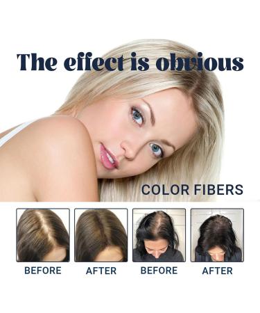 Thick Hair Fiber Powder Colored Hair Thickener Hair Fiber Powder Hair Fibers Refill Enhanced Hair Root Color Powder Hair Fiber Powder for Women & Men (Dark Brown) - Buy Online on GoSupps.com