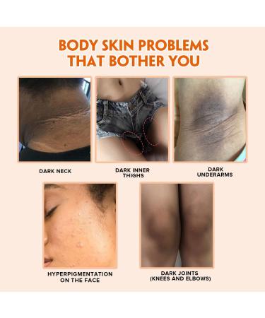 Turmeric Body Scrub - Dark Spot Exfoliating Body Scrub for Face & Neck Armpit Foot Butt Back - Moisturizing Body Exfoliator Scrub & Acne Blackhead Remover - Natural Body Skin Care Scrub - Buy Online on GoSupps.com