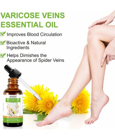 Varicose Veins & Spider Veins Essential Oil for Improved Leg Circulation - 30ML - Buy Online on GoSupps.com