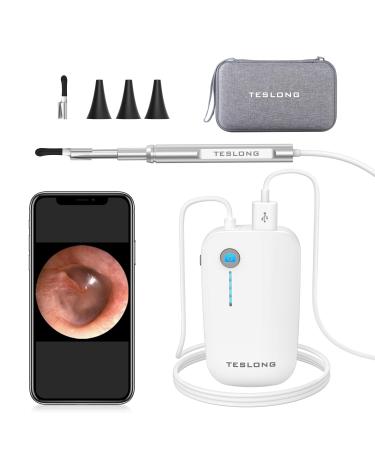 Teslong Otoscope HD ear wax removered ultra-thin wireless otoscope with light ear endoscope compatible with Android and iPhone 15 NTE100i-EU