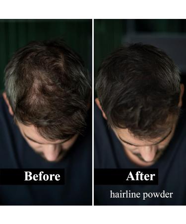 Leon Miguel Approach Powder | Waterproof Hair Concealer for Men & Women - Invisible Makeup - 4G White - Buy Online on GoSupps.com