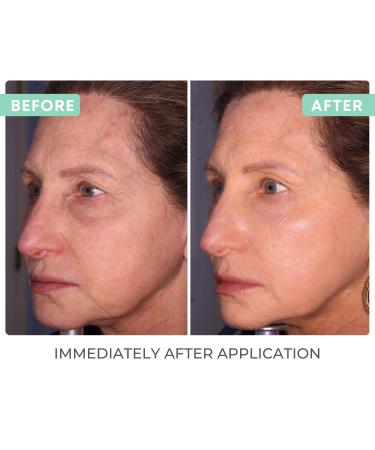 Reflect SPF 42 Tinted Moisturizer with Zinc Oxide & Titanium Dioxide | Hyaluronic Acid & Vitamin E | Medical Grade Acne Sunblock & Anti-Aging Face Moisturizer | 2.1 OZ - Buy Online on GoSupps.com