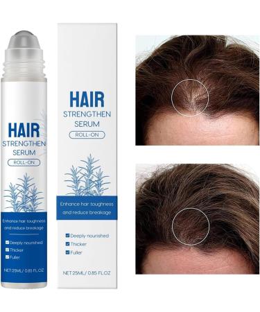 Hair Growth Roller Hair loss 25ML Lightweight Nourishing Follicle Strengthening Hair Care For Older Friend - Buy Online on GoSupps.com