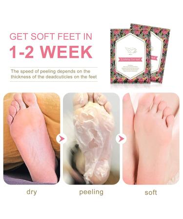 5 Pack Foot Peeling Mask - Exfoliating Rose Foot Scrub for Soft Smooth Feet | Dead Skin Remover for Men & Women - International Shipping - Buy Online on GoSupps.com