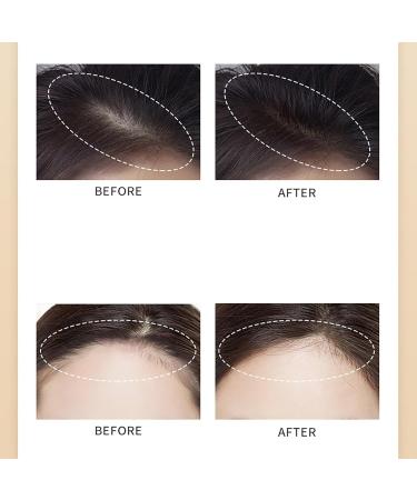 Maycheer Hairline Shadow Powder 01 - Dark Brown Root Touch Up & Hairline Powder for Women | Waverloo Magic & Simplife Hairline Solutions - Buy Online on GoSupps.com