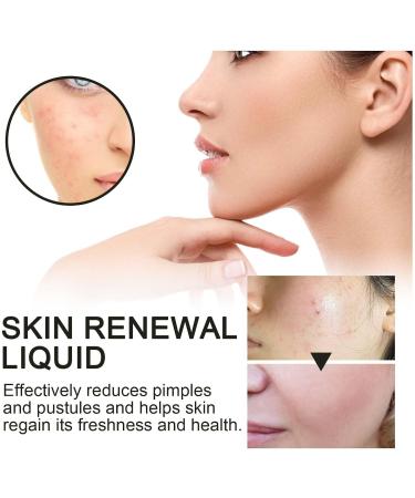 GeRRiT Poreclear 2% BHA Skin Fluid Facial Skin Refining Serum Skin Liquid Facial Exfoliator Facial Exfoliating Serum 2pcs - Buy Online on GoSupps.com