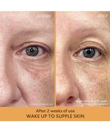 Sahajan Golden Glow Eye Balm | Anti-Aging Cream for Dark Circles Eye Bags & Wrinkles | Ghee Gotu Kola & Rose Oil | .5oz - Buy Online on GoSupps.com