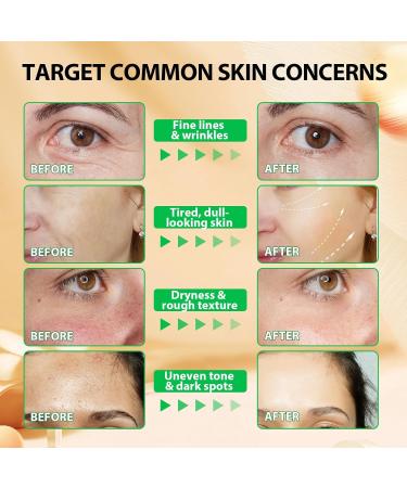 Vitamine E Huile Huile De Vitamine E 75 000 Ui 100% Naturel vitamine e Liquide Pure pour le Visage les Cheveux les Ongles et la Peau Anti- ge et Anti-rides Pour les Cicatrices et les Vergetures - Buy Online on GoSupps.com