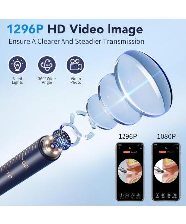 Ear Wax Removal Ear Cleaner with Camera 1296P HD Visual Ear Cleaner with 6 LED Lights and Flexible Tip FSA HSA Eligible Items Safe Ear Wax Removal Kit with Camera Ear Cleaning Tool for Family Gifts Black - Buy Online on GoSupps.com