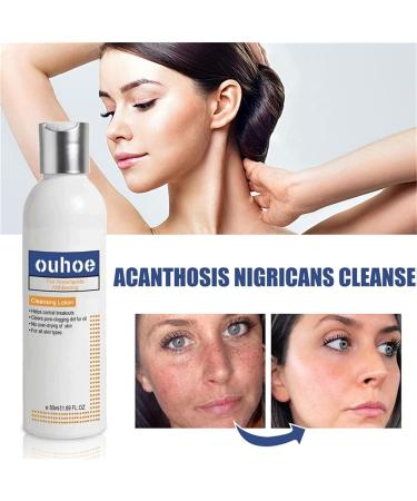 Cleansing Lotion for Acne & Spots | Acanthosis Nigricans Treatment Set - Salyzap Body Wash, Nigrifree Cream, Therapy Oil | 50ml - 1 Count (Pack of 2) - Buy Online on GoSupps.com