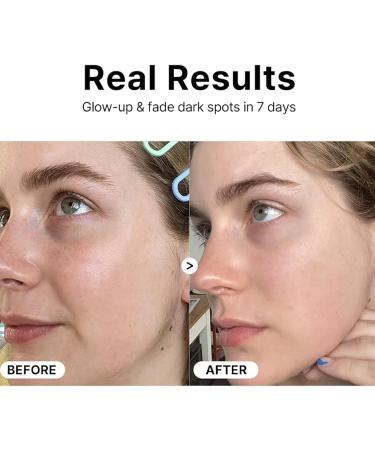 YAOPIU Facial moisture solution moisturizing brightening firming 30 ml facial care solution for women for day and night for makeup for sensitive oily and - Buy Online on GoSupps.com