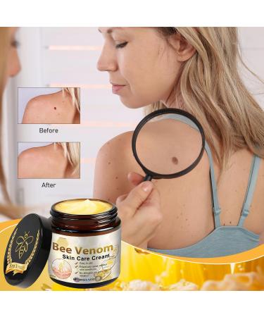 Bee Venom Skin Treatment Cream Bee Venom Repair Cream Professional Bee Venom Gel Hydrating Moisturizing Suitable For All Skin Types (2PCS) - Buy Online on GoSupps.com