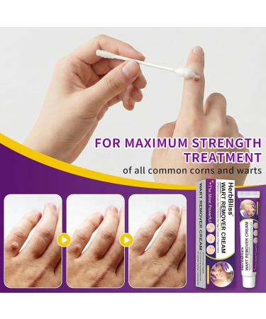 Wart Remover Cream 20g, Wart Removal Cream for Plantar Warts, Common Warts, Flat Warts - Buy Online on GoSupps.com