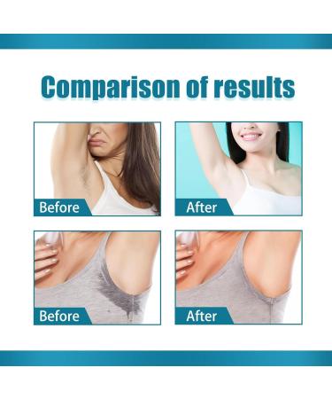 Quick Drying Underarm Deodorant Antiperspirant Balm for Home and Travel - Odor Neutralizing Formula - Buy Online on GoSupps.com