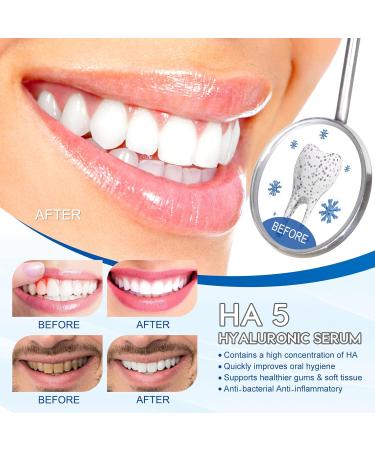 Enamel-Friendly Repair Toothpaste - Advanced Science Formula - Stain-Away & Plaque Removal - 30ml - Buy Online on GoSupps.com