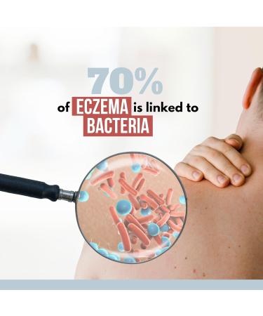 NOVEHA Eczema Relief | Soothing Hypochlorous Acid Spray | Skin Care for Kids & Adults | Fast Relief | Gentle Natural Hydration for Dry Sensitive Skin | 8 OZ Eczema Spray - Buy Online on GoSupps.com
