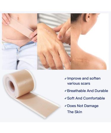 Silicone Scar Sheets 6 Pack for C-Section, Surgery, Burn, Post-Acne & Stretch Marks - 4x150cm - Buy Online on GoSupps.com