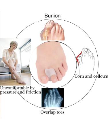 10 Piece Toe Protectors & Spacers for Big Toe Bunion & Hammer Toes - Clear - Buy Online on GoSupps.com