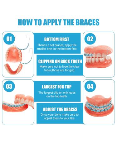 4 Pair of Temporary Tooth Decoration Teeth Retainer Practical Brackets para Dientes Sturdy Retenedores de Dientes Ortodoncia Props for Dental Students to Practice (Blue) - Buy Online on GoSupps.com
