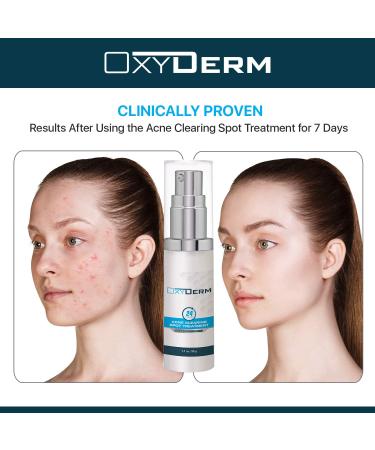Overnight Acne Spot Treatment | Fast Relief for All Skin Types | Effective Blackhead & Pimple Removal - Buy Online on GoSupps.com