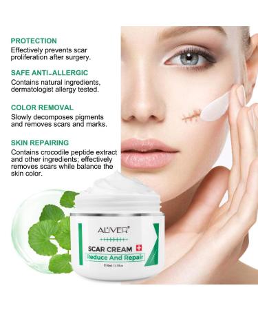 Scar Removal Cream for Old Scars, Stretch Marks & Burns - Natural Skin Repair for Acne Scars & Spots - Buy Online on GoSupps.com