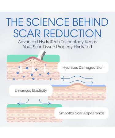 Medical Grade Silicone Scar Gel - Touch-Free Brush Applicator for Surgical Scars Burns Acne & Keloids - Effective Scar Treatment - Buy Online on GoSupps.com