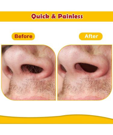 Nose Hair Wax Kit - 120g Wax with 40 Applicators & 20 Wipes - Painless Hair Removal for Men and Women - Buy Online on GoSupps.com