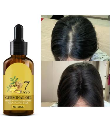 Hppsctink germinal oil 30 ml - Buy Online on GoSupps.com