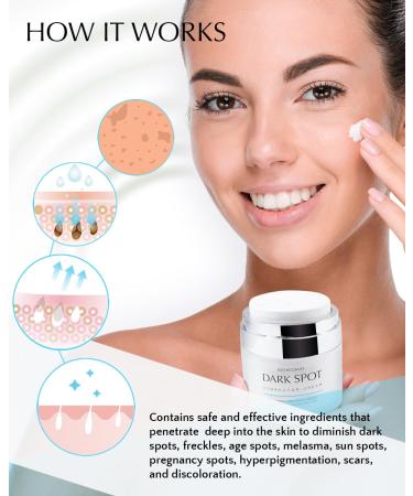 Dark Spot Remover for Face & Body | Hyperpigmentation Treatment for Freckles Melasma Sun & Age Spots - Buy Online on GoSupps.com