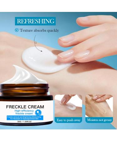 IZBEAUVO Dark Spot Remover for Face and Body Freckle Removal Cream Pigmentation Removal Cream Dark Spot Corrector Cream for Sun Spots Melasma Freckle Dark Spot Sun Spot Age Spot - Buy Online on GoSupps.com