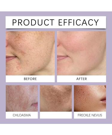 Dark Spot Correcting Glow Serum 30 Ml S rum claircissant Soin De La Peau Cor en Anti Tache Visage Skincare Coreen Korean Skincar Soin Des Taches Sombres Care De L'hyperpigmentation (1) - Buy Online on GoSupps.com