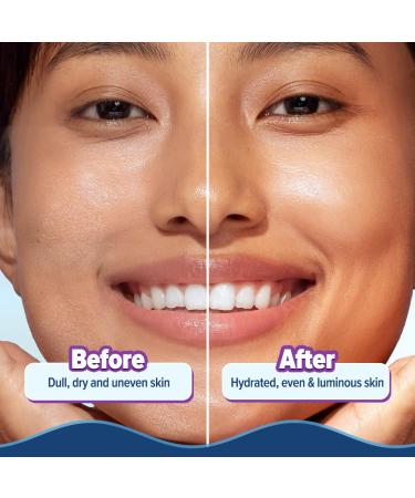 Aqualogica Illuminate + Hydra Gel Face Moisturizer | 24 Hour Deep Hydration for Oily to Combination Skin | with Wild Berries & Alpha Arbutin | Water-Like Gel Texture | 7.05 Oz/200g - Buy Online on GoSupps.com