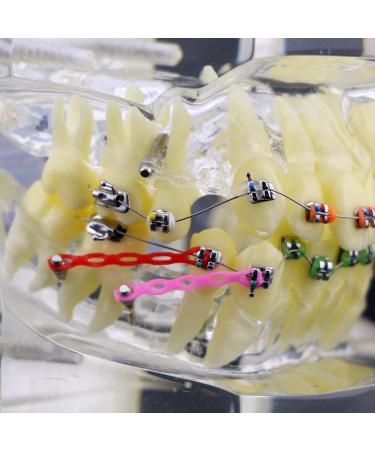 Orthodontic Tooth Model Orthodontic Dental Treatment Malocclusion Model with Brackets Chain Wire - Buy Online on GoSupps.com