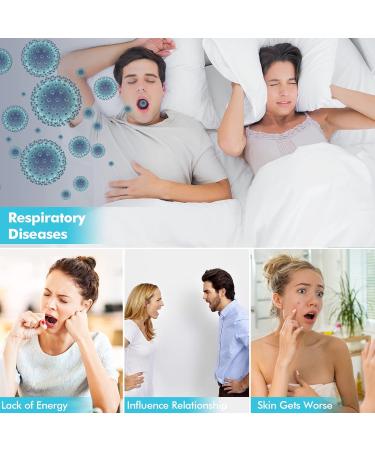 2023 Upgrade Anti Snoring Chin Strap for Men and Women - Sleep Aid for Mouth Breathers - Buy Online on GoSupps.com
