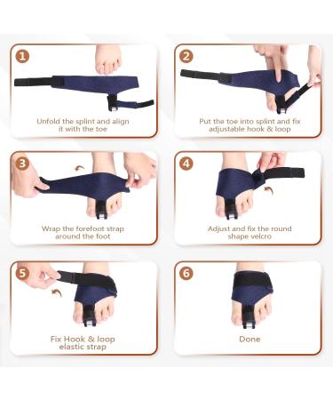 Toe Straightener & Hammer Toe Corrector | Support for Broken Claw Bent Crooked Curled & Mallet Toes | International Shipping - Buy Online on GoSupps.com