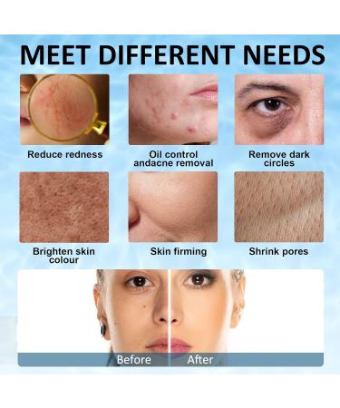 Ice Face Roller Mold - Reusable Silicone for Reducing Eye Bags & Dark Circles | Best Skin Care Tool - Buy Online on GoSupps.com