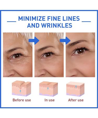 Jennifer Aniston Anti-Aging Serum Set - Botox Stock Solution, Wrinkle Reduction, Dark Spot Corrector - 3PCS - Buy Online on GoSupps.com