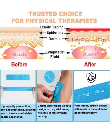 ATETEO Kinesiology Tape Skin Color M - 5m x 3.8cm | Flexible Support Tape - Buy Online on GoSupps.com