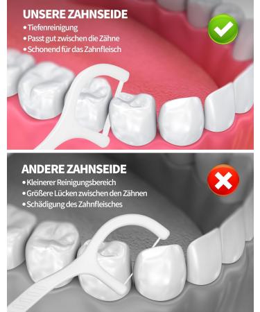 Netonda 200 PCS Gentle Dental Insult for Sensitive Gums | Fluffzen Fluff-Tahnband for Pain-Sensitive Teeth - Ideal for Dental Rooms - Buy Online on GoSupps.com