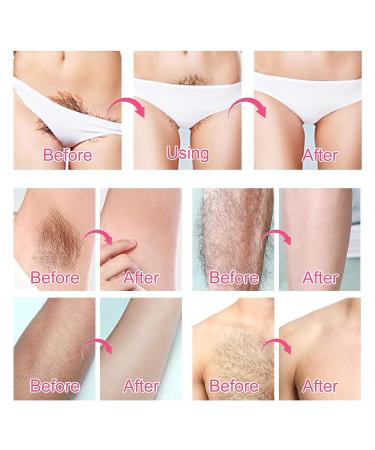 Intimate Hair Removal Cream for Women and Men - Effective & Painless Depilatory Cream for Private Areas, Bikini, Body, Legs, Underarms - All Skin Types - 60g - Buy Online on GoSupps.com