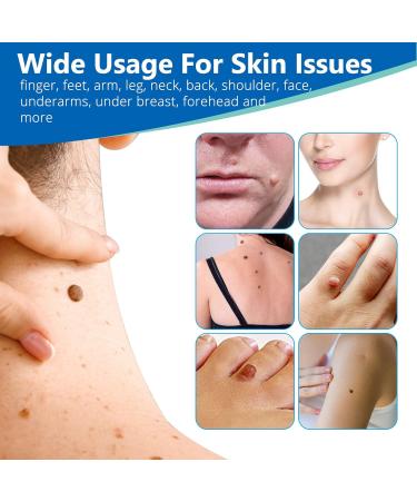 Kit Pour L' Limination Des Taches Cutan Es - Upgraded Skin Tag Removal Avec 36 Patchs De R Paration De La Peau - Action Rapide Et S Re - Petite Grande Taille (1-9mm) Pour Le Visage Et Le Corps - Buy Online on GoSupps.com