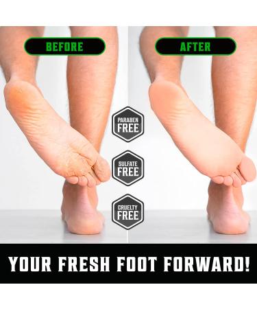 Viking Revolution Tea Tree Foot Cream - Moisturizing Foot Balm for Dry Cracked Heels and Feet - 8oz Foot Repair Cream with Aloe Vera and Mint - Buy Online on GoSupps.com