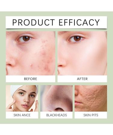 Mung Bean Foam Cleanser pH-Balanced Purifying Face Wash Gently Cleanses Excess Oil & Dirt for Smooth Refreshed Skin Daily Facial Cleanser for Oily & Combination Skin - Buy Online on GoSupps.com