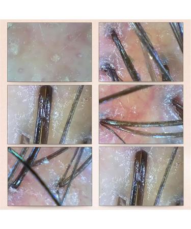 Skin Hair Analyser Scalp Hair Detector with 50X & 200X Lens 2 Million Pixel HD LCD Screen Stop Motion HD Images Comprehensive Skin Detection for Home Beauty Salon Spa - Buy Online on GoSupps.com