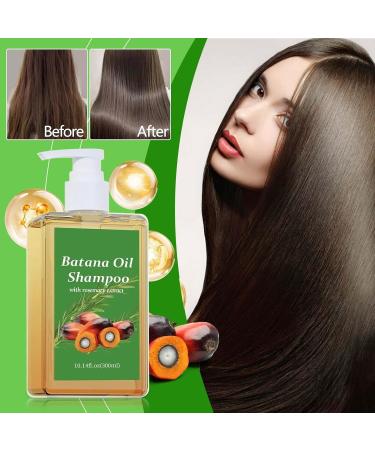 Lot de 2 shampoings l'huile Batana 2025 - 300 ml - Shampooing anti-chute - quilibre la teneur en graisse limine les pellicules agit contre les d mangeaisons - Hydrate - Lisse les cheveux - Buy Online on GoSupps.com